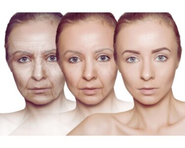 糖尿病とアンチエイジング：健康的に若々しく生きるための血糖コントロールのアイキャッチ画像