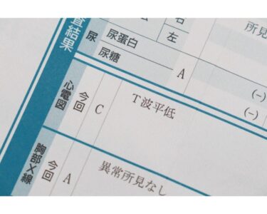 健康診断で「心電図異常」と言われたら？松戸の循環器内科専門医がわかりやすく解説のアイキャッチ画像