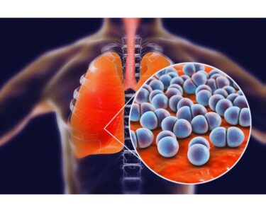 【2026年4月~】肺炎球菌ワクチン「プレベナー20」が定期接種に!65歳になったら知っておきたいことのアイキャッチ画像