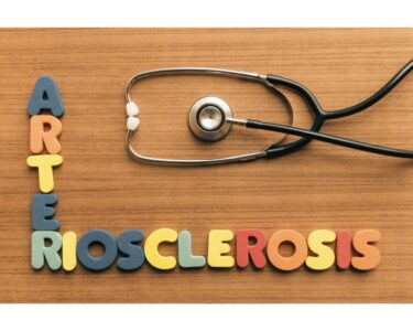 動脈硬化と生活習慣の深い関係｜今日から始める血管を守る実践法のアイキャッチ画像